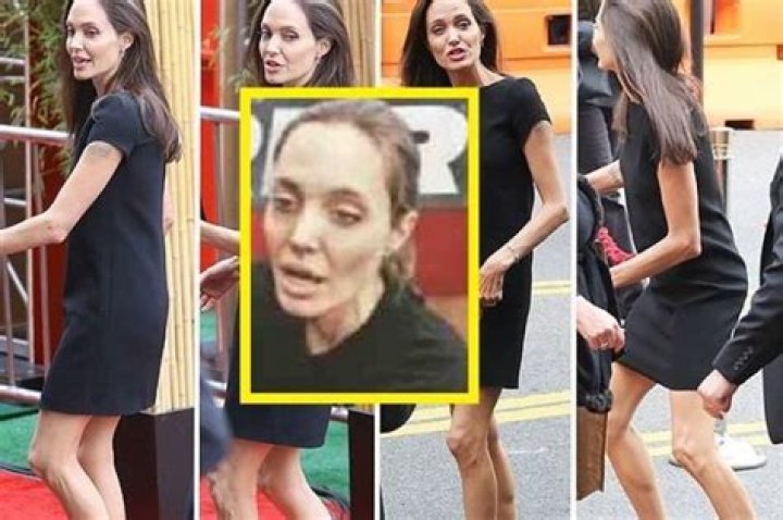 Angelina Jolie's Battle With Anorexia: A Deep Dive Into Her Journey