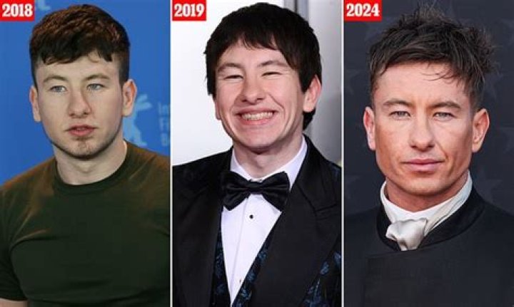 Unveiling The Truth Behind Barry Keoghan's Plastic Surgery Rumors