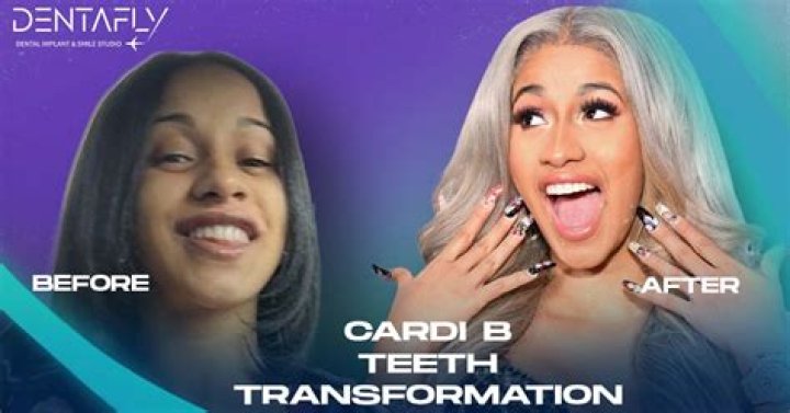 Cardi B's Teeth Cost Revealed!