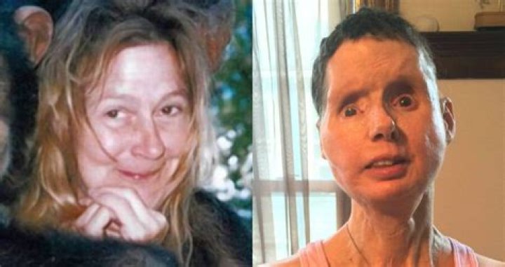 Unbreakable Spirit: The Journey Of Charla Nash