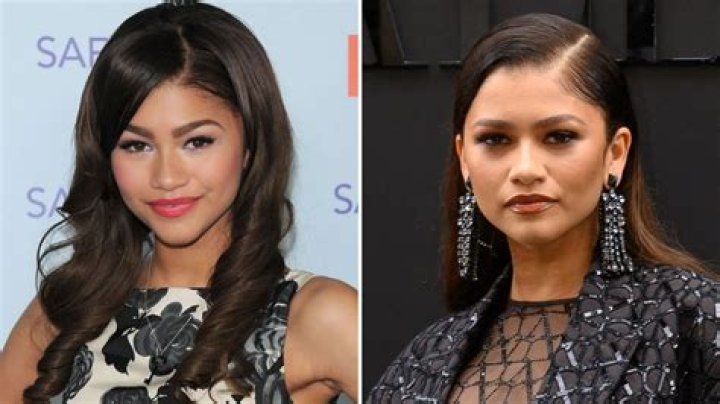 Zendaya's Plastic Surgery Journey: Uncovering The Truth