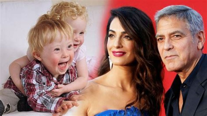 Unraveling The Truth: Does Alexander Clooney Have Down Syndrome?
