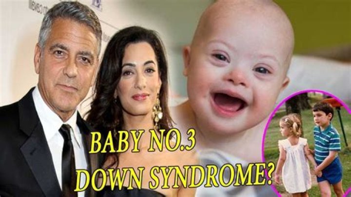 Do George Clooney's Twins Have Down Syndrome? - Truth Revealed