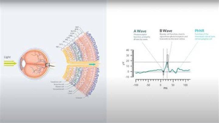 Discover Essential Erg Images: Your Ultimate Visual Guide