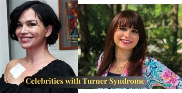 Unveiling The Extraordinary: Celebrities With Turner Syndrome