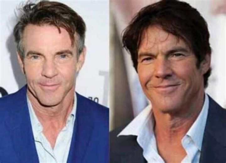 Has Dennis Quaid Undergone Plastic Surgery? The Truth Revealed