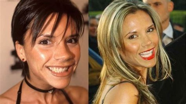 Has Victoria Beckham Done Weight Loss? Before And After Photo