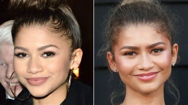 Unlocking The Truth: Zendaya's Plastic Surgery Journey