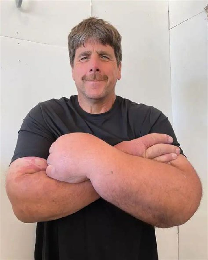 Unveiling The Strength Of Jeff Dabe: The Arm Wrestling Sensation