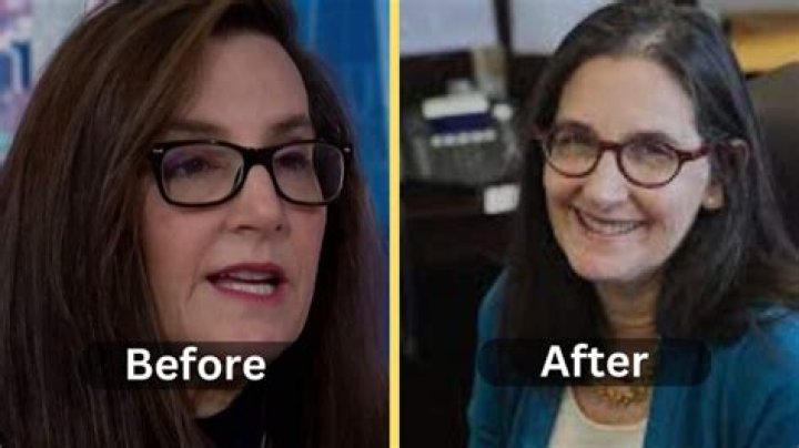 Unveil The Secrets Of A Joyce Vance Facelift: Discoveries And Insights