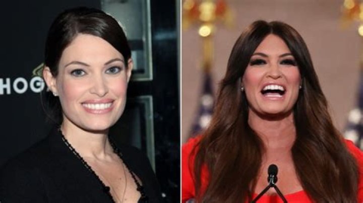 Unveiling The Transformation: Kimberly Guilfoyle's Cosmetic Surgery Journey