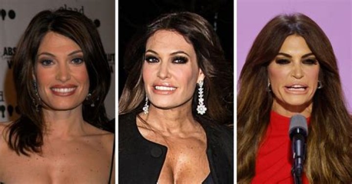 Kimberly Guilfoyle's Ozempic Transformation: Before And After Reveal