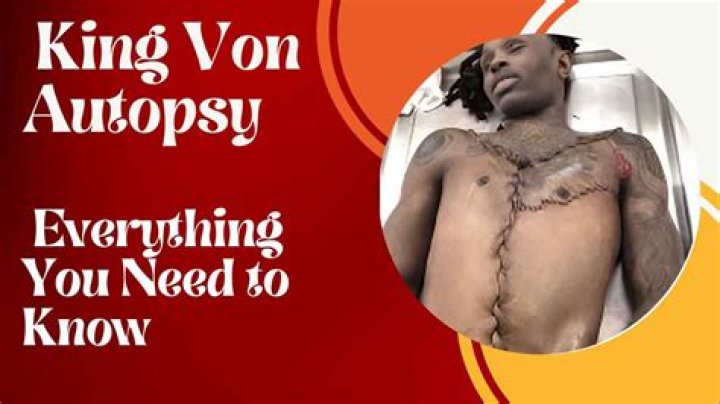 Witness The Tragic Aftermath: King Von Autopsy Photos [WARNING: Graphic]