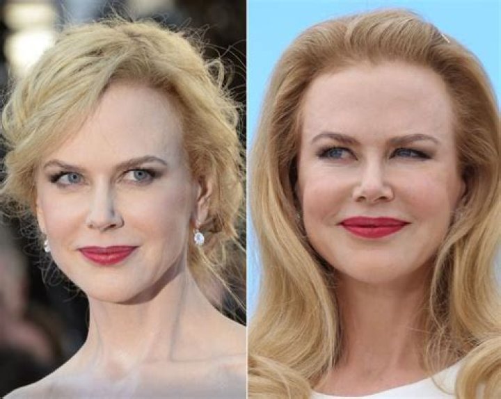 The Incredible Transformation Of Nicole Kidman: A Journey Through The Years