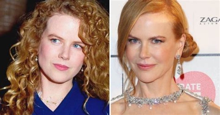 Nicole Kidman's Transformation: Unlocking The Secrets Of Her Changing Face