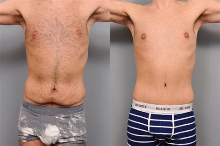 Discover Captivating Tummy Photos: A Visual Gallery