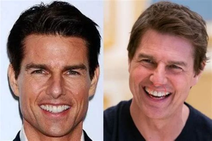 Unveiling The Mystery Behind Tom Cruise’s Iconic Tooth