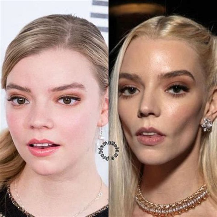 Unraveling Anya Taylor-Joy's Diverse Ethnic Heritage: A Cultural Tapestry