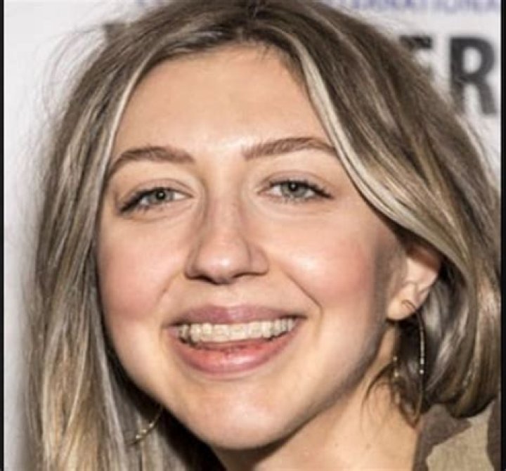 What Is Wrong With Heidi Gardner Teeth